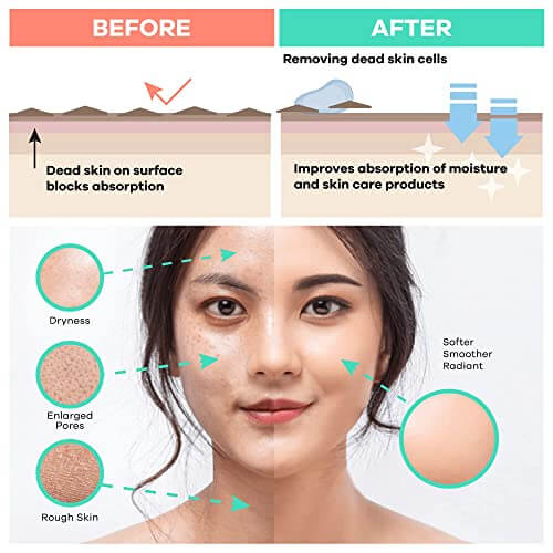 Infographic for comparison of skin before and after using of exfoliating scrub for face.