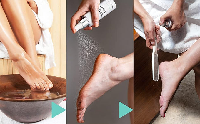 Dermasuri Exfoliante de pies removedor de callos – Fórmula exfoliante en  aerosol para pies y lima de pies reutilizable de lujo – Removedor de piel